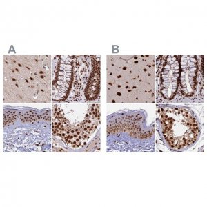 Anti-FAM103A1 antibody produced in rabbit 