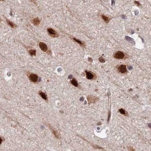 Anti-FAM103A1 antibody produced in rabbit 