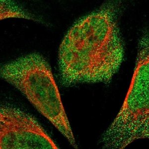 Anti-FAM104A antibody produced in rabbit 