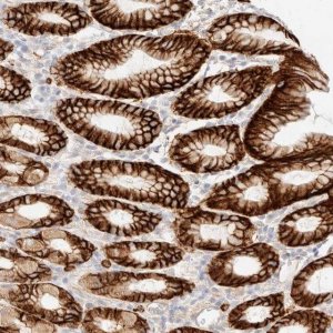 Anti-FAM129B antibody produced in rabbit 