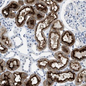 Anti-FAM151A antibody produced in rabbit 