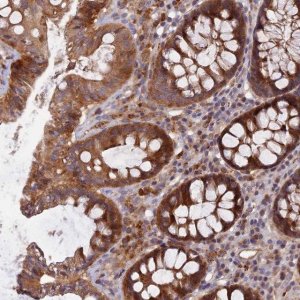 Anti-FAM151B antibody produced in rabbit 
