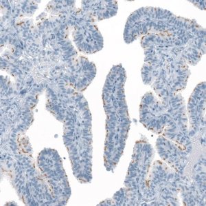 Anti-FAM161A antibody produced in rabbit 