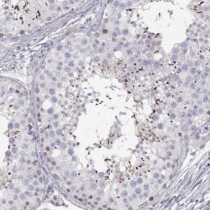 Anti-FAM166A antibody produced in rabbit 