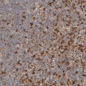 Anti-FAM167A antibody produced in rabbit 