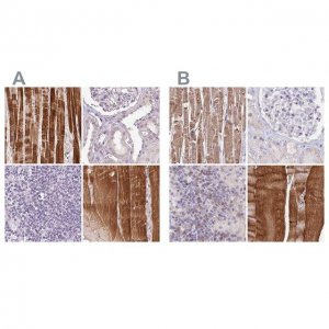Anti-FAM168B antibody produced in rabbit 