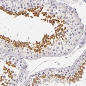 Anti-FAM181A antibody produced in rabbit 