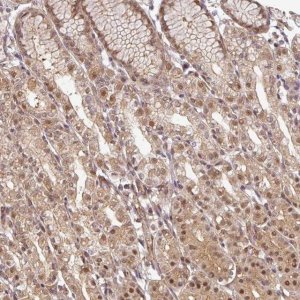 Anti-FAM192A antibody produced in rabbit 
