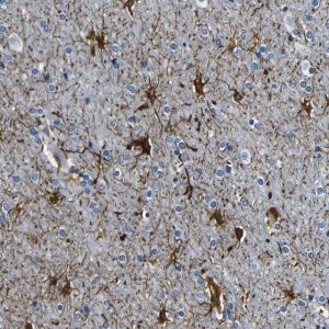 Anti-FAM19A1 antibody produced in rabbit HPA013407-100UL