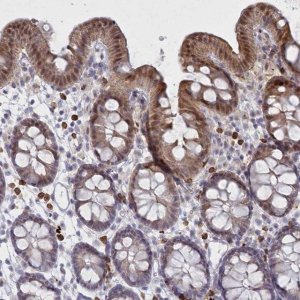 Anti-FAM206A antibody produced in rabbit 