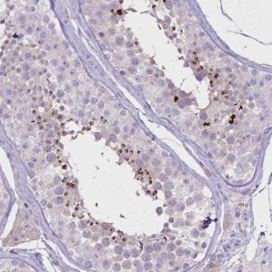 Anti-FAM209B antibody produced in rabbit 