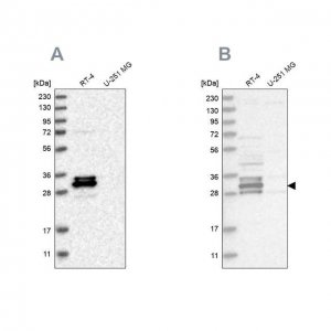Anti-FAM221A antibody produced in rabbit 