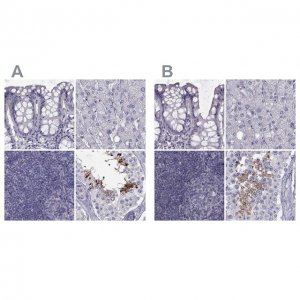 Anti-FAM71B antibody produced in rabbit 