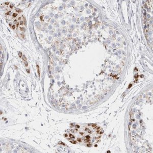 Anti-FAM71F2 antibody produced in rabbit 