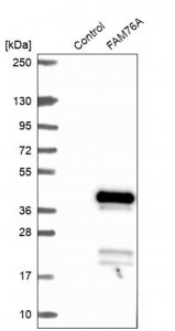 Anti-FAM76A antibody produced in rabbit HPA044762-100UL