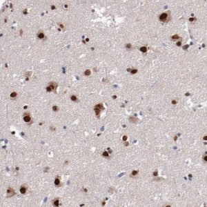 Anti-FAM81A antibody produced in rabbit 