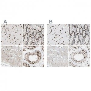 Anti-FAM98B antibody produced in rabbit HPA008320-100UL