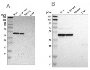 Anti-FAM98B antibody produced in rabbit HPA008320-100UL