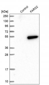 Anti-FARS2 antibody produced in rabbit 