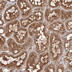 Anti-FARS2 antibody produced in rabbit 