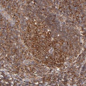 Anti-FARSA antibody produced in rabbit 