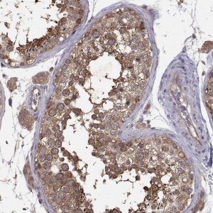 Anti-FARSB antibody produced in rabbit 