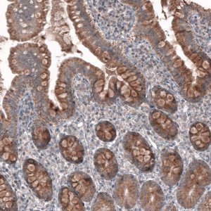 Anti-FASTKD1 antibody produced in rabbit 