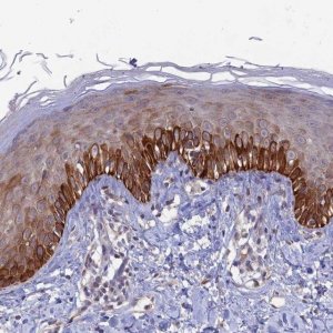 Anti-FASTKD5 antibody produced in rabbit HPA043833-100UL