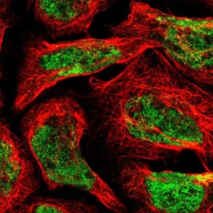 Anti-FBXL6 antibody produced in rabbit HPA008867-100UL