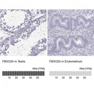 Anti-FBXO24 antibody produced in rabbit 
