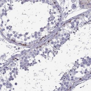 Anti-FBXO24 antibody produced in rabbit 