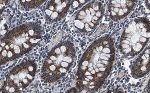 Anti-FBXO38 Antibody, clone 1I18 ZooMAb Rabbit Monoclonal 