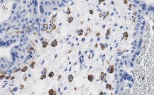 Anti-FCGR2B/CD32 Antibody, clone 3G17 ZooMAb Rabbit Monoclonal 