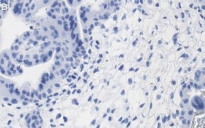 Anti-FCGR2B/CD32 Antibody, clone 3G17 ZooMAb Rabbit Monoclonal 