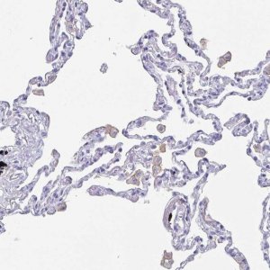Anti-FCGR3A antibody produced in rabbit 