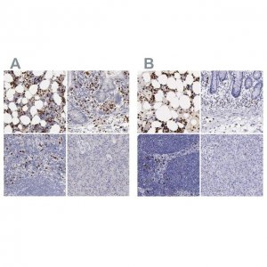 Anti-FCN1 antibody produced in rabbit HPA001295-100UL