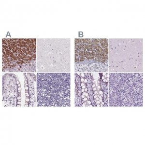 Anti-FDX1 antibody produced in rabbit 