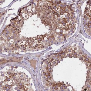 Anti-FEM1B antibody produced in rabbit 