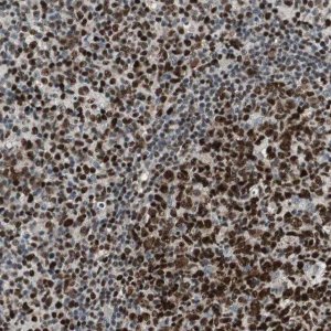 Anti-FEN1 antibody produced in rabbit 
