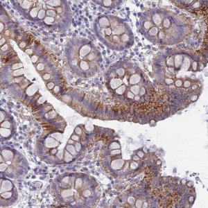 Anti-FERD3L antibody produced in rabbit 