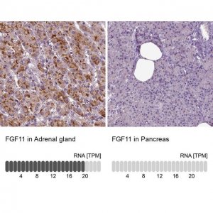 Anti-FGF11 