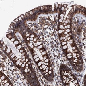 Anti-FGFBP2 antibody produced in rabbit 