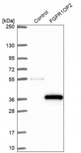Anti-FGFR1OP2 antibody produced in rabbit 