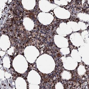 Anti-FGFR1OP2 antibody produced in rabbit 