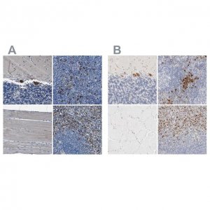 Anti-FGL2 antibody produced in rabbit HPA021011-100UL