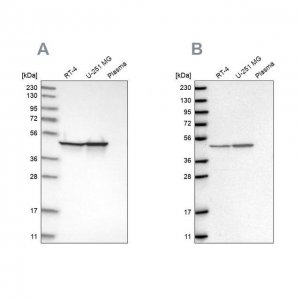 Anti-FH antibody produced in rabbit HPA025770-100UL