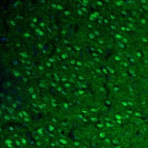 Anti-FH antibody produced in rabbit HPA025770-100UL