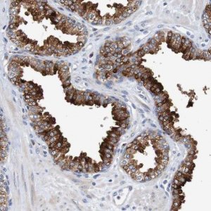 Anti-FIBP antibody produced in rabbit 