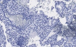 Anti-Fibrillin-1 Antibody, clone 6C19 ZooMAb Rabbit Monoclonal 