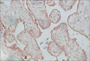 Anti-Fibroblast Growth Factor Receptor-2, Cytoplasmic antibody produced in rabbit F0300-.5ML